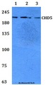 CHD5 Antibody - Western blot of CHD5 antibody at 1:500 Line1:HeLa whole cell lysate Line2:H9C2 whole cell lysate Line3:Raw264.7 whole cell lysate.
