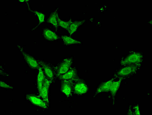 CHD5 Antibody - Immunofluorescent analysis of Hela cells using CHD5 Antibody at a dilution of 1:100 and Alexa Fluor 488-congugated AffiniPure Goat Anti-Rabbit IgG(H+L)