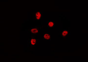 CHD5 Antibody - Staining HeLa cells by IF/ICC. The samples were fixed with PFA and permeabilized in 0.1% Triton X-100, then blocked in 10% serum for 45 min at 25°C. The primary antibody was diluted at 1:200 and incubated with the sample for 1 hour at 37°C. An Alexa Fluor 594 conjugated goat anti-rabbit IgG (H+L) Ab, diluted at 1/600, was used as the secondary antibody.