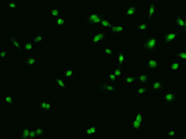 CHD5 Antibody - Immunofluorescence staining of CHD5 in PC3 cells. Cells were fixed with 4% PFA, permeabilzed with 0.1% Triton X-100 in PBS, blocked with 10% serum, and incubated with rabbit anti-Human CHD5 polyclonal antibody (dilution ratio 1:200) at 4°C overnight. Then cells were stained with the Alexa Fluor 488-conjugated Goat Anti-rabbit IgG secondary antibody (green). Positive staining was localized to Nucleus and Cytoplasm.