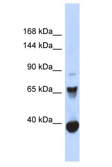 CHD6 Antibody - CHD6 antibody Western Blot of Fetal Muscle. Antibody dilution: 1 ug/ml.  This image was taken for the unconjugated form of this product. Other forms have not been tested.