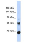 CHD6 Antibody - CHD6 antibody Western Blot of Fetal Muscle. Antibody dilution: 1 ug/ml.  This image was taken for the unconjugated form of this product. Other forms have not been tested.
