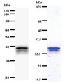 CHD6 Antibody - Western blot of immunized recombinant protein using CHD6 antibody. Left: CHD6 staining. Right: Coomassie Blue staining of immunized recombinant protein.
