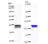 CHD6 Antibody - Left : Western blot analysis of immunized recombinant protein, using anti-CHD6 monoclonal antibody. Right : CBB staining of immunized recombinant protein.