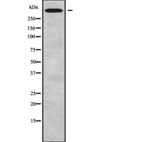 CHD6 Antibody - Western blot analysis of CHD6 using MCF-7 whole cells lysates