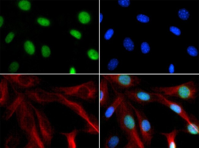 CHD7 Antibody - Immunocytochemistry/Immunofluorescence: Chd7 Antibody - Antibody was tested in NIH/3T3 cells with FITC (green). Nuclei and actin were counterstained with Dapi (blue) and Phalloidin (red).  This image was taken for the unconjugated form of this product. Other forms have not been tested.