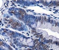 CHD7 Antibody - Immunohistochemistry: Chd7 Antibody - IHC of CHD7 in mouse intestine using DAB with hematoxylin counterstain.  This image was taken for the unconjugated form of this product. Other forms have not been tested.