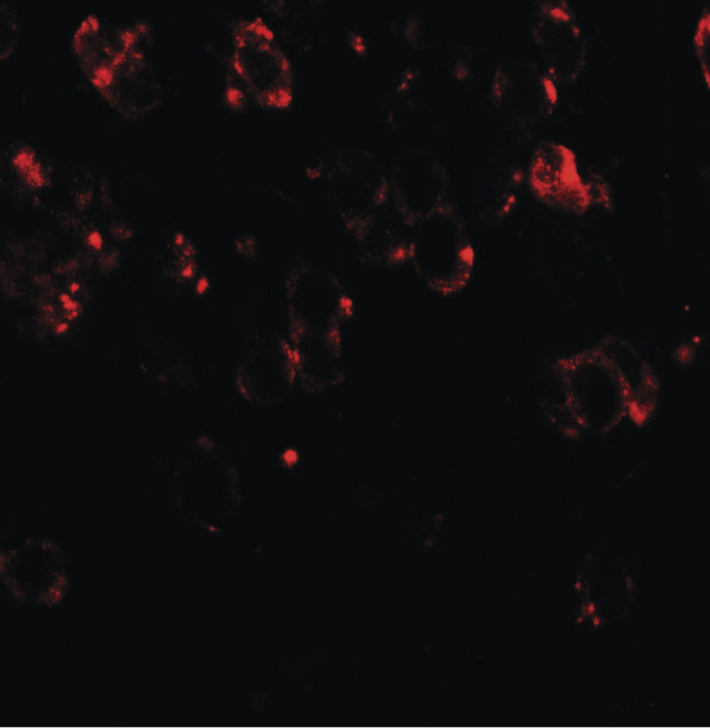 CHD7 Antibody - Immunofluorescence of CHD7 in mouse brain tissue with CHD7 antibody at 20 ug/ml.