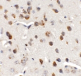 CHD7 Antibody - Immunohistochemistry of CHD7 in mouse brain tissue with CHD7 antibody at 5 ug/ml.