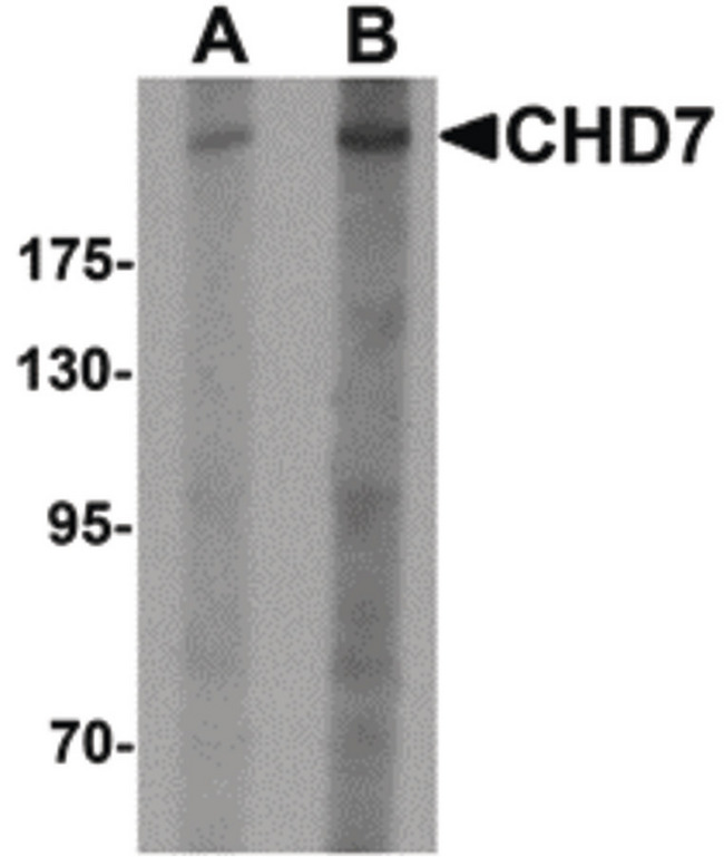 CHD7 Antibody - Western blot of CHD7 in SK-N-SH cell lysate with CHD7 antibody at (A) 1 and (B) 2 ug/ml.