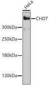 CHD7 Antibody - Western blot analysis of extracts of HeLa cells using CHD7 Polyclonal Antibody at dilution of 1:1000.