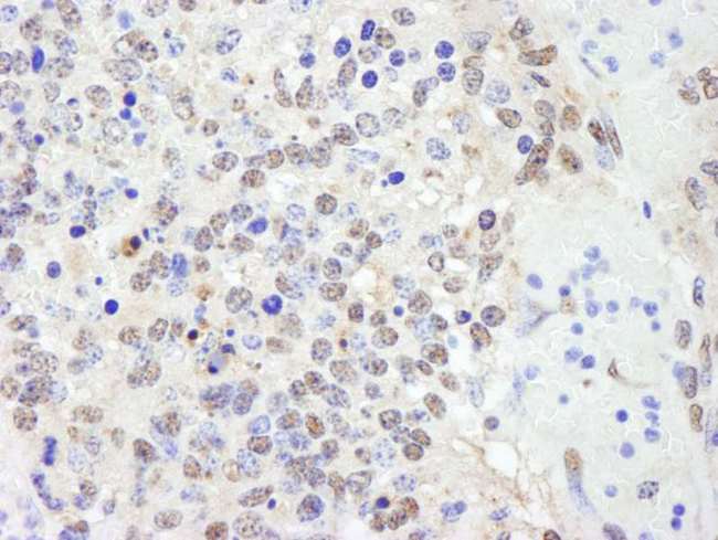 CHD8 Antibody - Detection of Mouse CHD8 by Immunohistochemistry. Sample: FFPE section of mouse teratoma. Antibody: Affinity purified rabbit anti-CHD8 used at a dilution of 1:100.