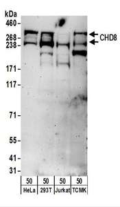 CHD8 Antibody - Detection of Human and Mouse CHD8 by Western Blot. Samples: Whole cell lysate (50 ug) from HeLa, 293T, Jurkat, and mouse TCMK-1 cells. Antibodies: Affinity purified rabbit anti-CHD8 antibody used for WB at 0.1 ug/ml. Detection: Chemiluminescence with an exposure time of 3 minutes.