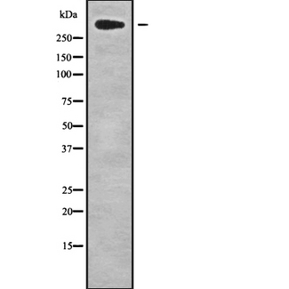 CHD8 Antibody - Western blot analysis of CHD8 using HepG2 whole cells lysates