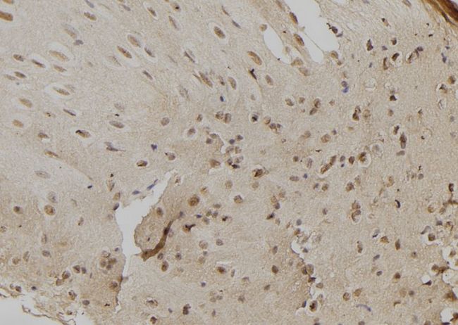 CHD8 Antibody - 1:100 staining mouse liver tissue by IHC-P. The sample was formaldehyde fixed and a heat mediated antigen retrieval step in citrate buffer was performed. The sample was then blocked and incubated with the antibody for 1.5 hours at 22°C. An HRP conjugated goat anti-rabbit antibody was used as the secondary.