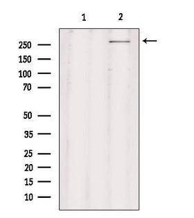 CHD8 Antibody - Western blot analysis of extracts of rat brain tissue using CHD8 antibody. Lane 1 was treated with the blocking peptide.