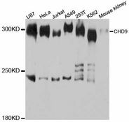 CHD9 Antibody - Western blot analysis of extracts of various cell lines, using CHD9 antibody at 1:3000 dilution. The secondary antibody used was an HRP Goat Anti-Rabbit IgG (H+L) at 1:10000 dilution. Lysates were loaded 25ug per lane and 3% nonfat dry milk in TBST was used for blocking. An ECL Kit was used for detection and the exposure time was 1s.