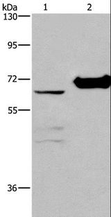 CHDH / CHD Antibody - Western blot analysis of 231 cell and mouse kidney tissue, using CHDH Polyclonal Antibody at dilution of 1:400.