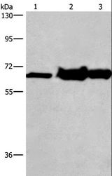 CHDH / CHD Antibody - Western blot analysis of 231 cell, mouse kidney and liver tissue, using CHDH Polyclonal Antibody at dilution of 1:500.