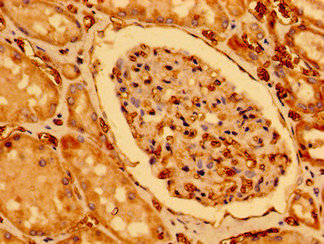 CHDH / CHD Antibody - Immunohistochemistry image of paraffin-embedded human kidney tissue at a dilution of 1:100