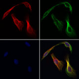 CHDH / CHD Antibody - Staining HeLa cells by IF/ICC. The samples were fixed with PFA and permeabilized in 0.1% Triton X-100, then blocked in 10% serum for 45 min at 25°C. Samples were then incubated with primary Ab(1:200) and mouse anti-beta tubulin Ab(1:200) for 1 hour at 37°C. An AlexaFluor594 conjugated goat anti-rabbit IgG(H+L) Ab(1:200 Red) and an AlexaFluor488 conjugated goat anti-mouse IgG(H+L) Ab(1:600 Green) were used as the secondary antibod