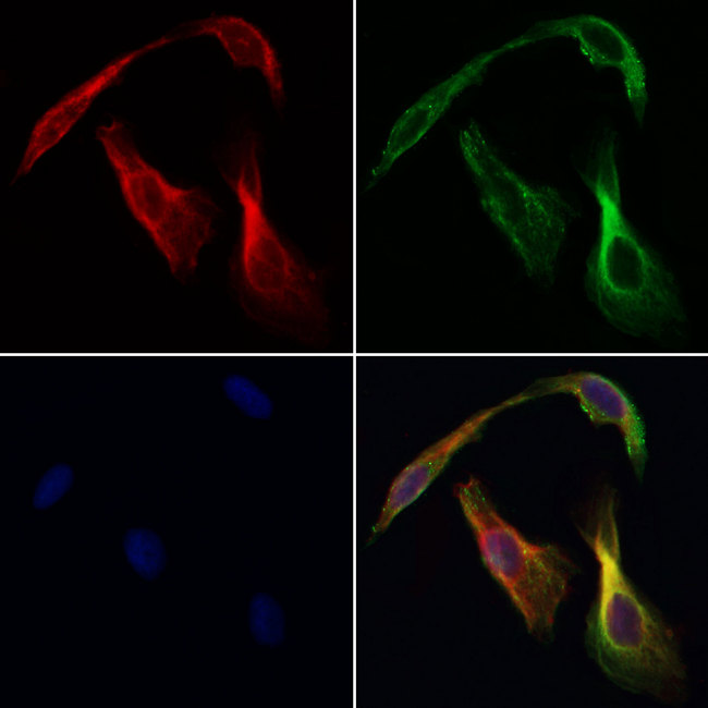 CHDH / CHD Antibody - Staining HeLa cells by IF/ICC. The samples were fixed with PFA and permeabilized in 0.1% Triton X-100, then blocked in 10% serum for 45 min at 25°C. Samples were then incubated with primary Ab(1:200) and mouse anti-beta tubulin Ab(1:200) for 1 hour at 37°C. An AlexaFluor594 conjugated goat anti-rabbit IgG(H+L) Ab(1:200 Red) and an AlexaFluor488 conjugated goat anti-mouse IgG(H+L) Ab(1:600 Green) were used as the secondary antibod