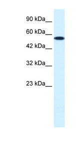 CHEK1 / CHK1 Antibody - CHEK1 / CHK1 antibody Western blot of HepG2 cell lysate. This image was taken for the unconjugated form of this product. Other forms have not been tested.