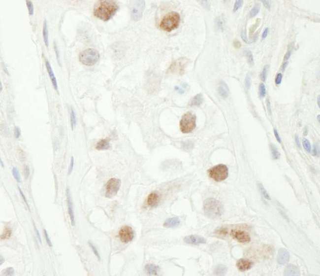 CHEK1 / CHK1 Antibody - Detection of Human Chk1 by Immunohistochemistry. Samples: FFPE section of human testis. Antibody: Affinity purified rabbit anti-Chk1 used at a dilution of 1:100. Detection: DAB.