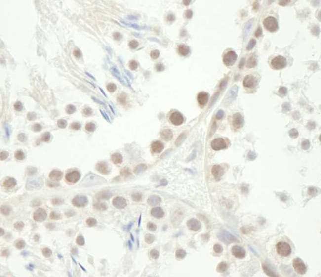 CHEK1 / CHK1 Antibody - Detection of Mouse Chk1 by Immunohistochemistry. Samples: FFPE sections of mouse testis. Antibody: Affinity purified rabbit anti-Chk1 used at a dilution of 1:100. Detection: DAB.