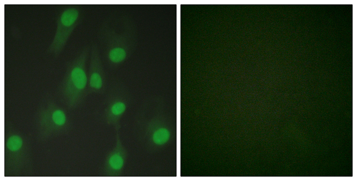 CHEK1 / CHK1 Antibody - Immunofluorescence analysis of HeLa cells, using Chk1 Antibody. The picture on the right is blocked with the synthesized peptide.