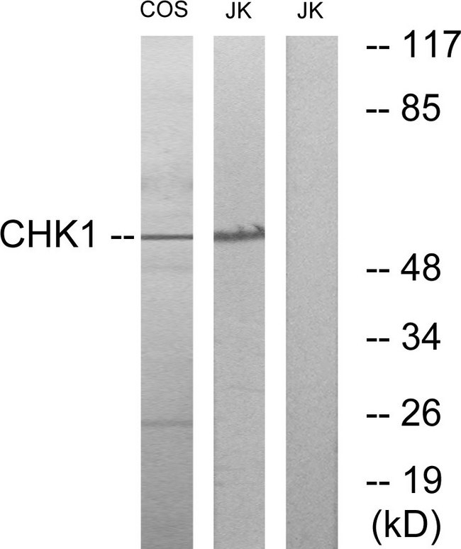 CHEK1 / CHK1 Antibody - Western blot analysis of lysates from COS7 and JurKat cells, using Chk1 Antibody. The lane on the right is blocked with the synthesized peptide.