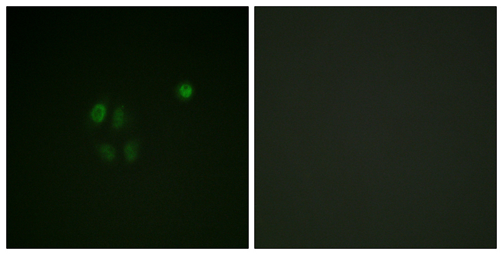 CHEK1 / CHK1 Antibody - Immunofluorescence analysis of A549 cells, using Chk1 Antibody. The picture on the right is blocked with the synthesized peptide.