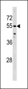 CHEK1 / CHK1 Antibody - CHEK1 Antibody (Center S296) western blot of HepG2 cell line lysates (35 ug/lane). The CHEK1 antibody detected the CHEK1 protein (arrow).