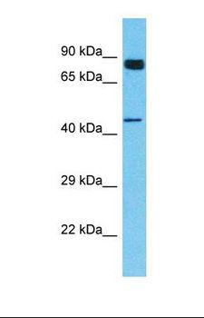 CHEK1 / CHK1 Antibody - Western blot of Human HT1080. CHEK1 antibody dilution 1.0 ug/ml.  This image was taken for the unconjugated form of this product. Other forms have not been tested.