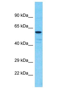 CHEK1 / CHK1 Antibody - CHEK1 / CHK1 antibody Western Blot of PANC1. Antibody dilution: 3 ug/ml.  This image was taken for the unconjugated form of this product. Other forms have not been tested.