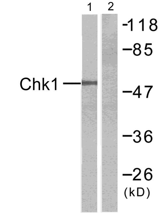 CHEK1 / CHK1 Antibody - Western blot analysis of lysates from HT-29 cells, treated with UV, using Chk1 Antibody. The lane on the right is blocked with the synthesized peptide.
