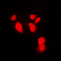 CHEK1 / CHK1 Antibody - Immunofluorescent analysis of CHK1 staining in HeLa cells. Formalin-fixed cells were permeabilized with 0.1% Triton X-100 in TBS for 5-10 minutes and blocked with 3% BSA-PBS for 30 minutes at room temperature. Cells were probed with the primary antibody in 3% BSA-PBS and incubated overnight at 4 C in a humidified chamber. Cells were washed with PBST and incubated with a DyLight 594-conjugated secondary antibody (red) in PBS at room temperature in the dark. DAPI was used to stain the cell nuclei (blue).