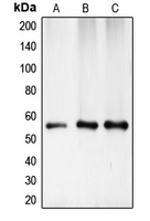 CHEK1 / CHK1 Antibody - Western blot analysis of CHK1 expression in HeLa (A); mouse kidney (B); rat heart (C) whole cell lysates.