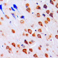 CHEK1 / CHK1 Antibody - Immunohistochemical analysis of CHK1 staining in human brain formalin fixed paraffin embedded tissue section. The section was pre-treated using heat mediated antigen retrieval with sodium citrate buffer (pH 6.0). The section was then incubated with the antibody at room temperature and detected using an HRP conjugated compact polymer system. DAB was used as the chromogen. The section was then counterstained with hematoxylin and mounted with DPX.