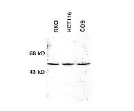 CHEK1 / CHK1 Antibody - Western analysis of Chk1 protein in the indicated cell lines. Sheep polyclonal antibody was used at 1:500 dilution.