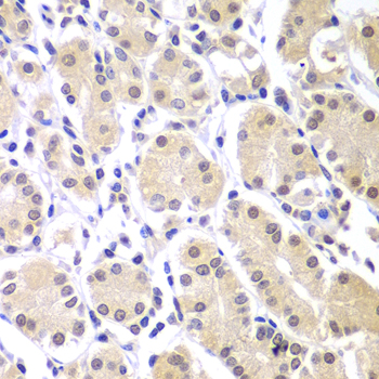 CHEK1 / CHK1 Antibody - Immunohistochemistry of paraffin-embedded human gastric tissue.