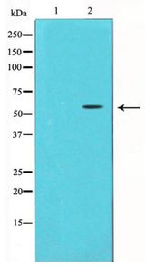CHEK1 / CHK1 Antibody - Western blot of Chk1 expression in HeLa whole cell lysates,The lane on the left is treated with the antigen-specific peptide.