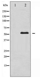 CHEK1 / CHK1 Antibody - Western blot of Chk1 expression in COS7 whole cell lysates,The lane on the left is treated with the antigen-specific peptide.