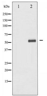 CHEK1 / CHK1 Antibody - Western blot of Chk1 expression in Raw264.7 whole cell lysates,The lane on the left is treated with the antigen-specific peptide.