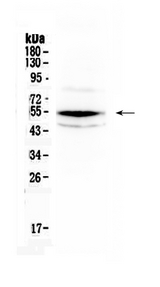 CHEK1 / CHK1 Antibody - Western blot - Anti-Chk1 Picoband Antibody