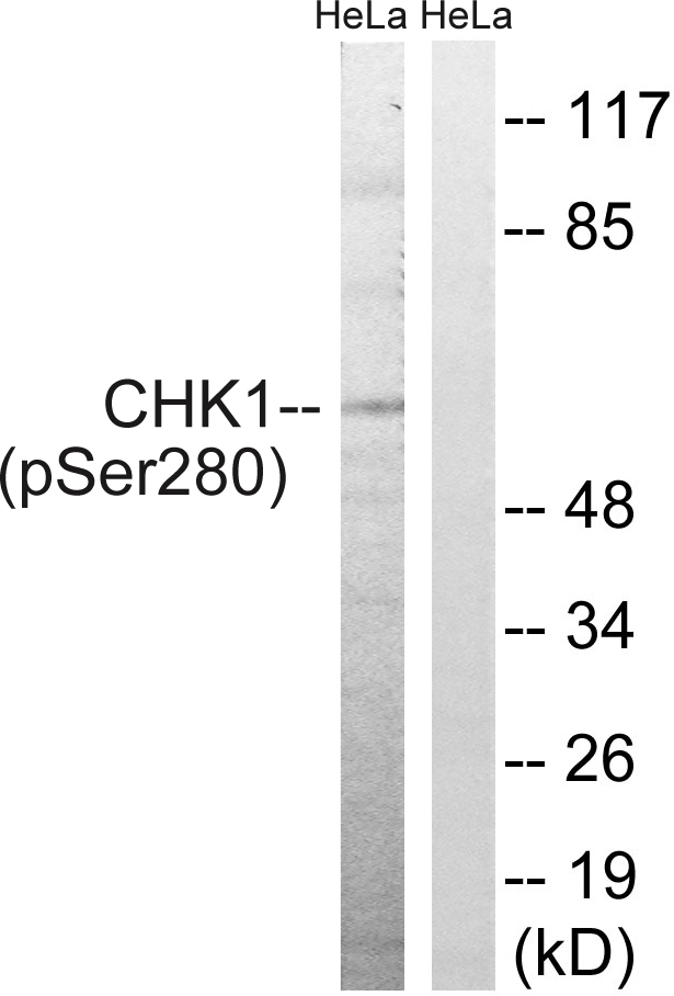 CHEK1 / CHK1 Antibody - Western blot analysis of lysates from HeLa cells treated with Hu 2nM 24hours, using Chk1 (Phospho-Ser280) Antibody. The lane on the right is blocked with the phospho peptide.