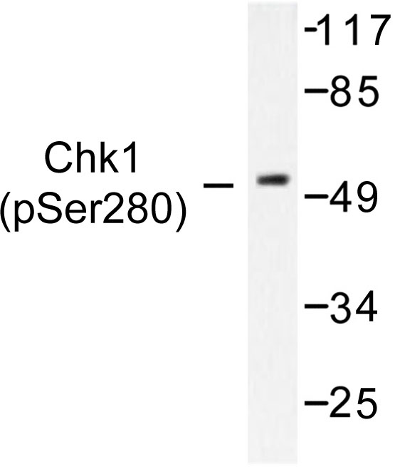 CHEK1 / CHK1 Antibody - Western blot of p-Chk1 (S280) pAb in extracts from HT29 cells treated with UV.