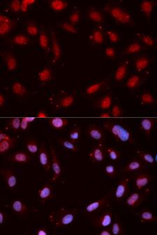 CHEK1 / CHK1 Antibody - Immunofluorescence analysis of MCF7 cells.