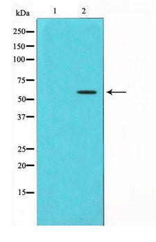 CHEK1 / CHK1 Antibody - Western blot of Chk1 phosphorylation expression in UV treated HT29 whole cell lysates,The lane on the left is treated with the antigen-specific peptide.