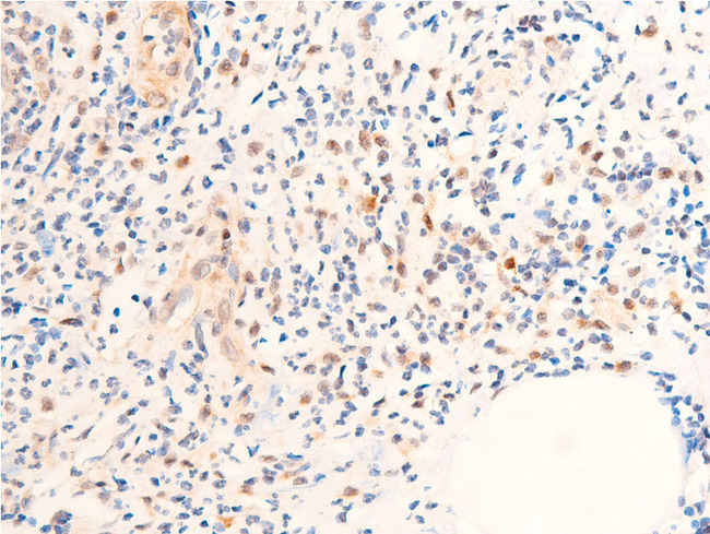 CHEK1 / CHK1 Antibody - 1:100 staining rat appendix tissue by IHC-P. The tissue was formaldehyde fixed and a heat mediated antigen retrieval step in citrate buffer was performed. The tissue was then blocked and incubated with the antibody for 1.5 hours at 22°C. An HRP conjugated goat anti-rabbit antibody was used as the secondary.